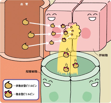総ビリルビン値異常時